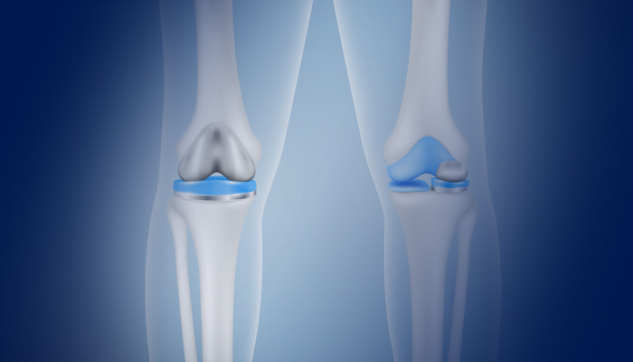 chirurgia-ginocchio-5 chirurgia-ginocchio-5
