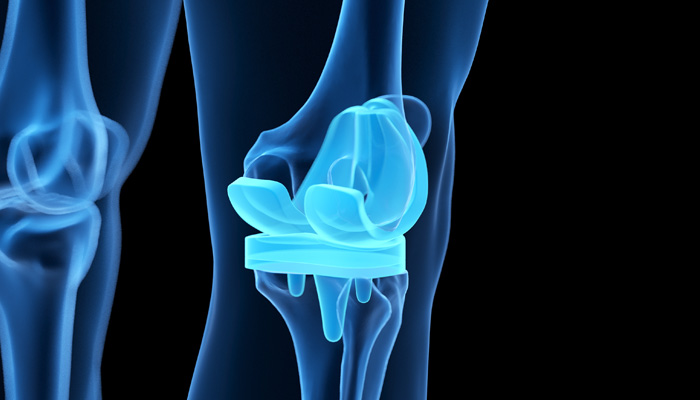 chirurgia-ginocchio-6 chirurgia-ginocchio-6